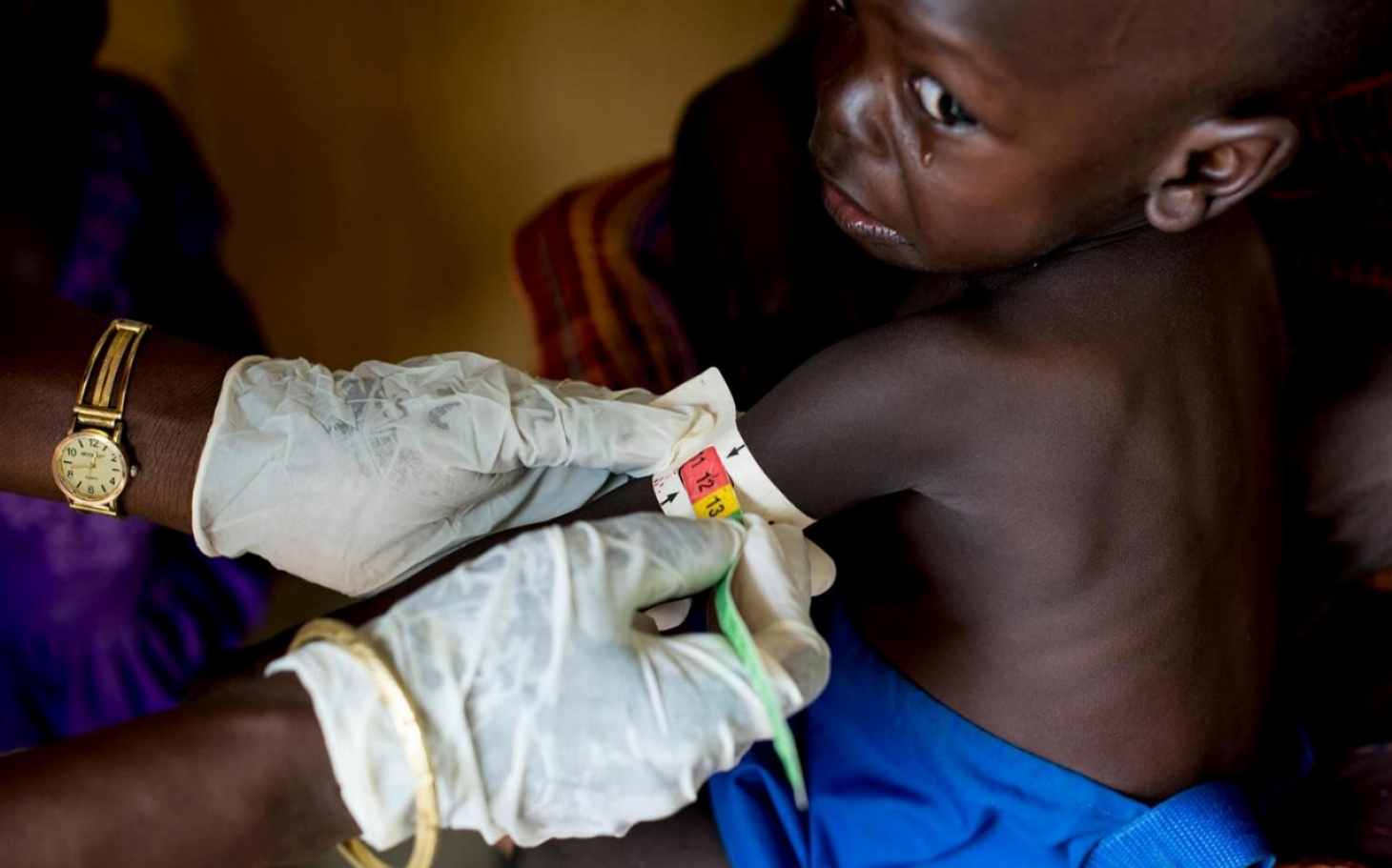 Children with Cancer in Sudan Fighting the Quietest Battle Amid War and Displacement