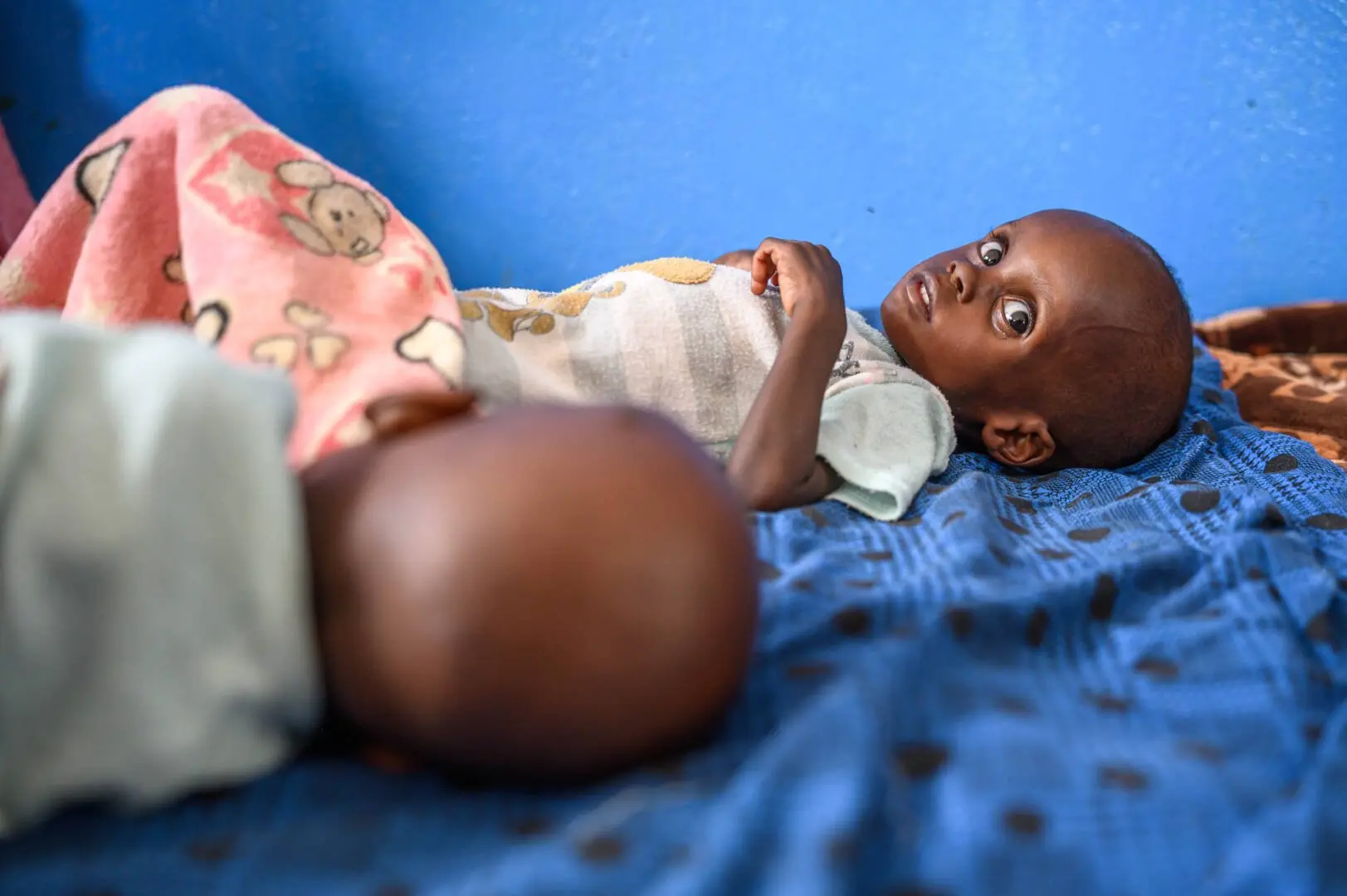 Kids Cancer in Sudan The Silent Emergency Affecting Children in the World's Largest Humanitarian Crisis