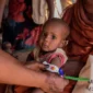Kids With Cancer in Sudan 85x85